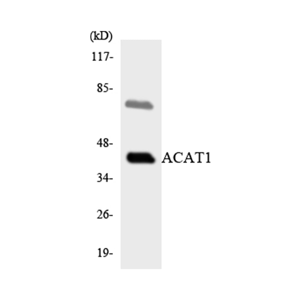 ACAT-1 Polyclonal Antibody, 20ul