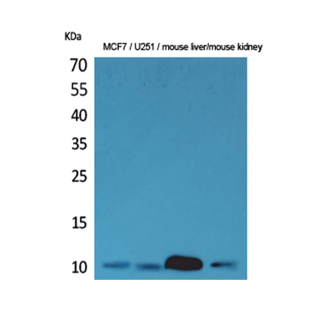ACBP Polyclonal Antibody, 20ul[BT-AP00147]
