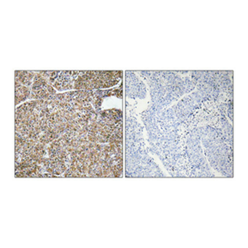 ACBP Polyclonal Antibody, 20ul[BT-AP00148]
