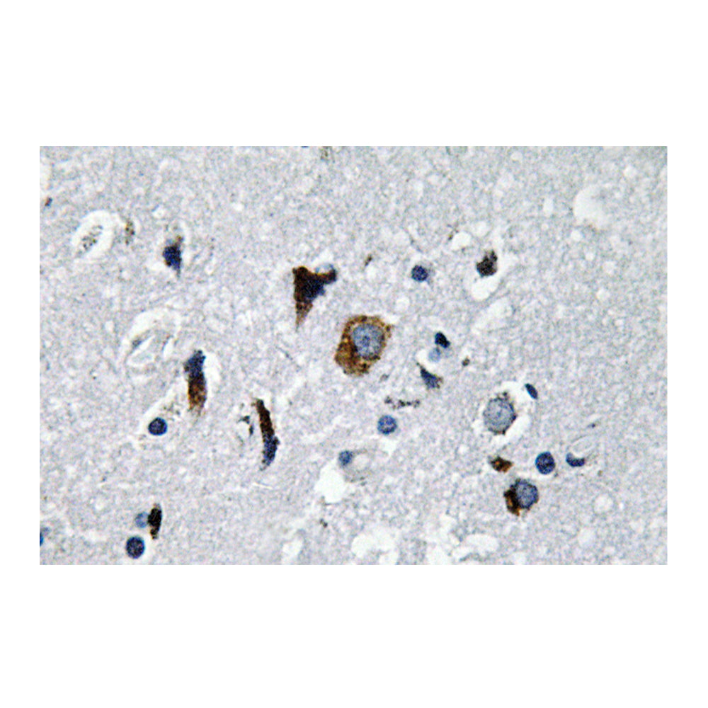 ACE1 Polyclonal Antibody, 20ul[BT-AP00151]