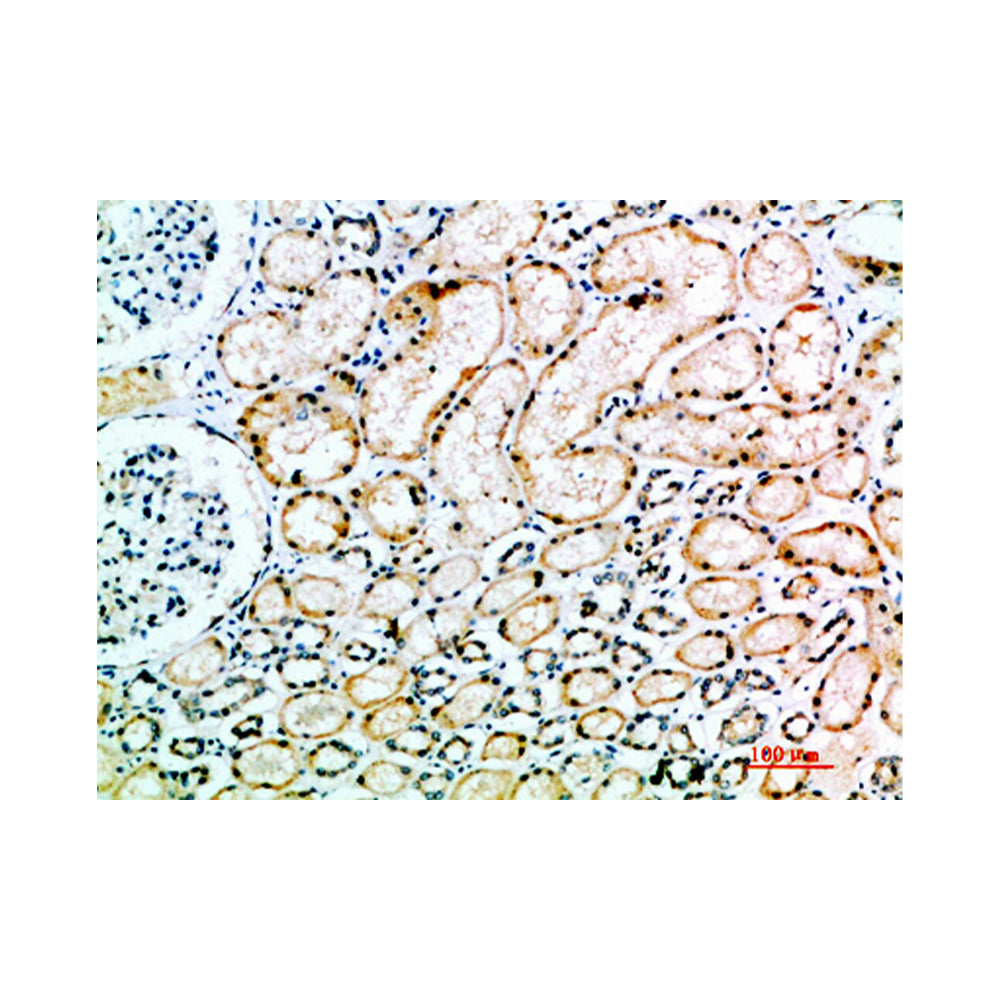 ACE1 Polyclonal Antibody, 20ul[BT-AP00152]