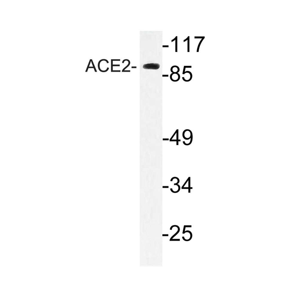 ACE2 Polyclonal Antibody, 20ul