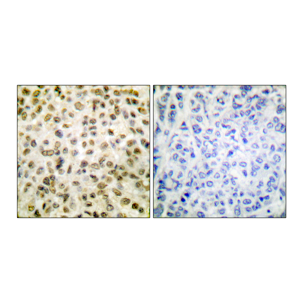Acetyl Histone H1 (K25) Polyclonal Antibody, 20ul