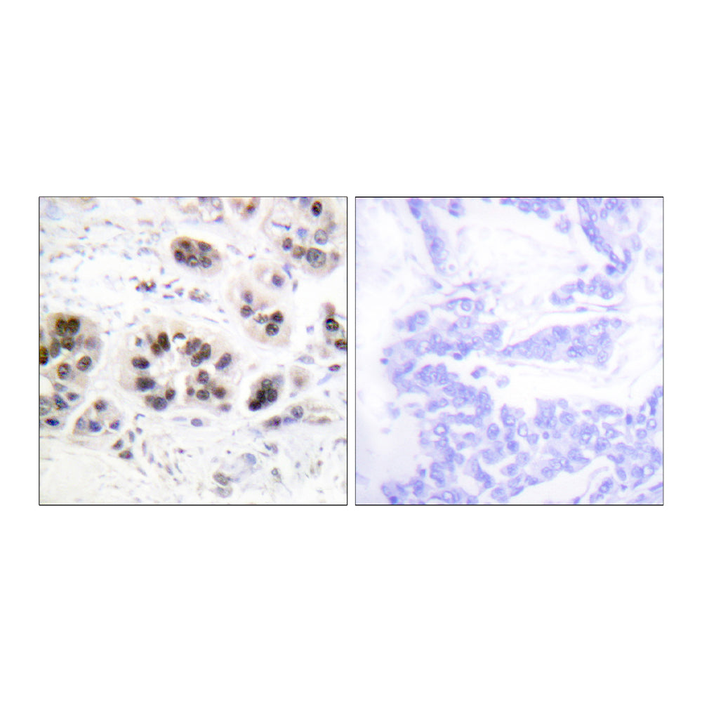 Acetyl Histone H2A (K5) Polyclonal Antibody, 20ul