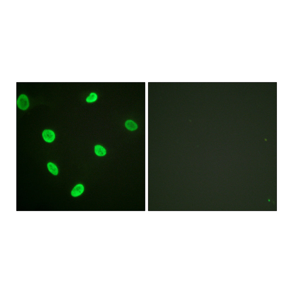 Acetyl Histone H2B (K12) Polyclonal Antibody, 20ul