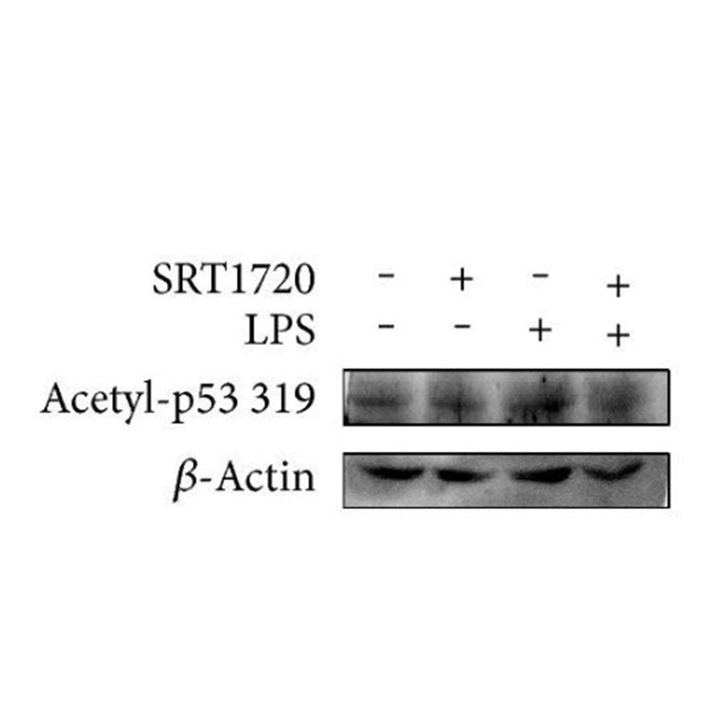 Acetyl p53 (K319) Polyclonal Antibody, 20ul