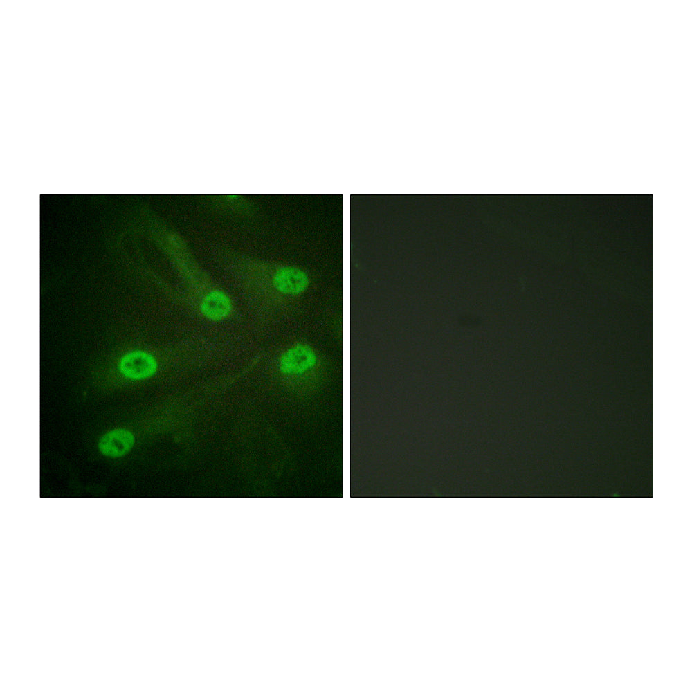 Acetyl p53 (K386) Polyclonal Antibody, 20ul