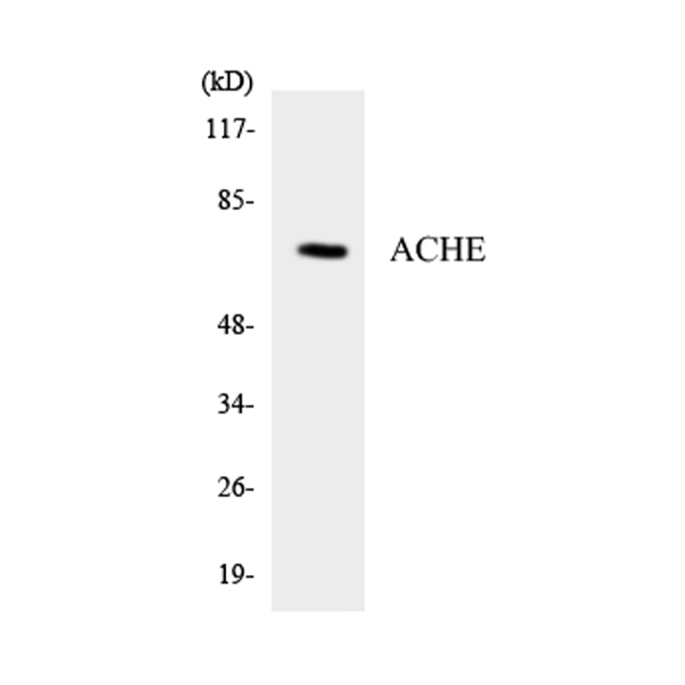 AChE Polyclonal Antibody, 20ul[BT-AP00167]