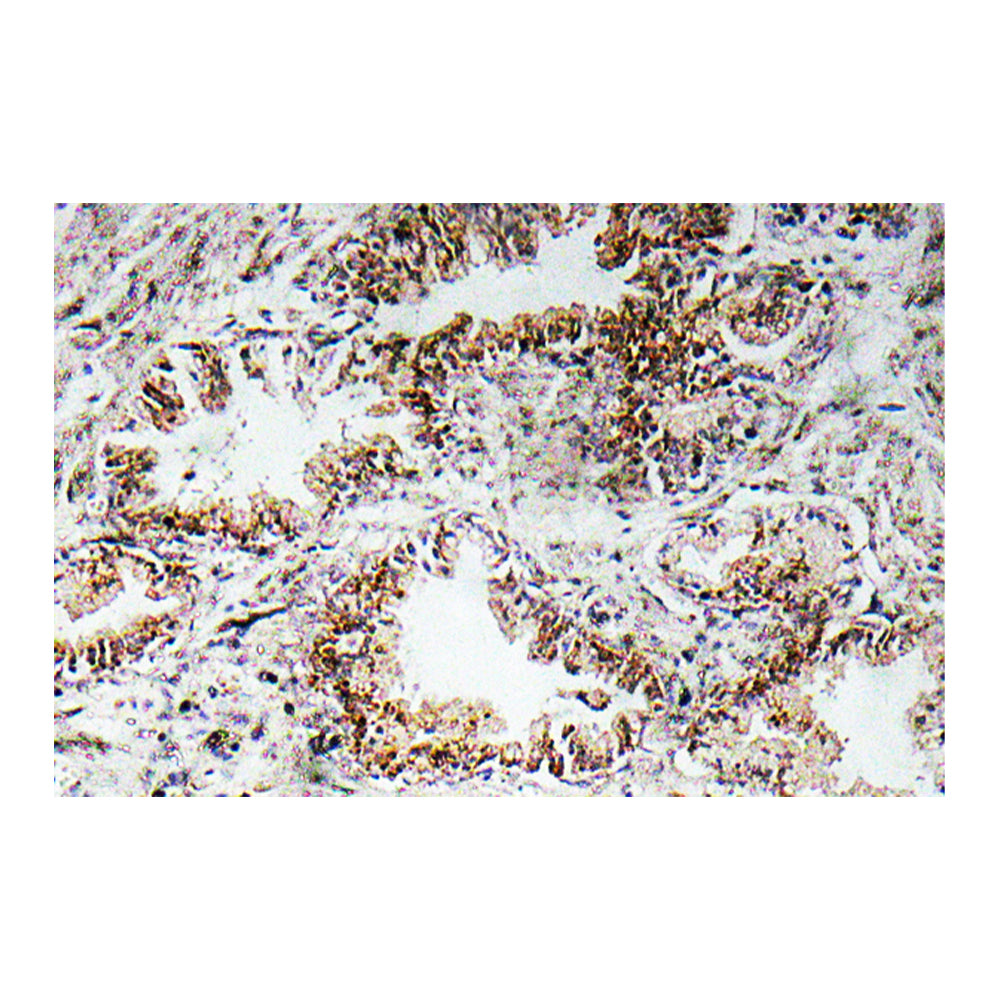 AChR Alpha1 Polyclonal Antibody, 20ul[BT-AP00170]
