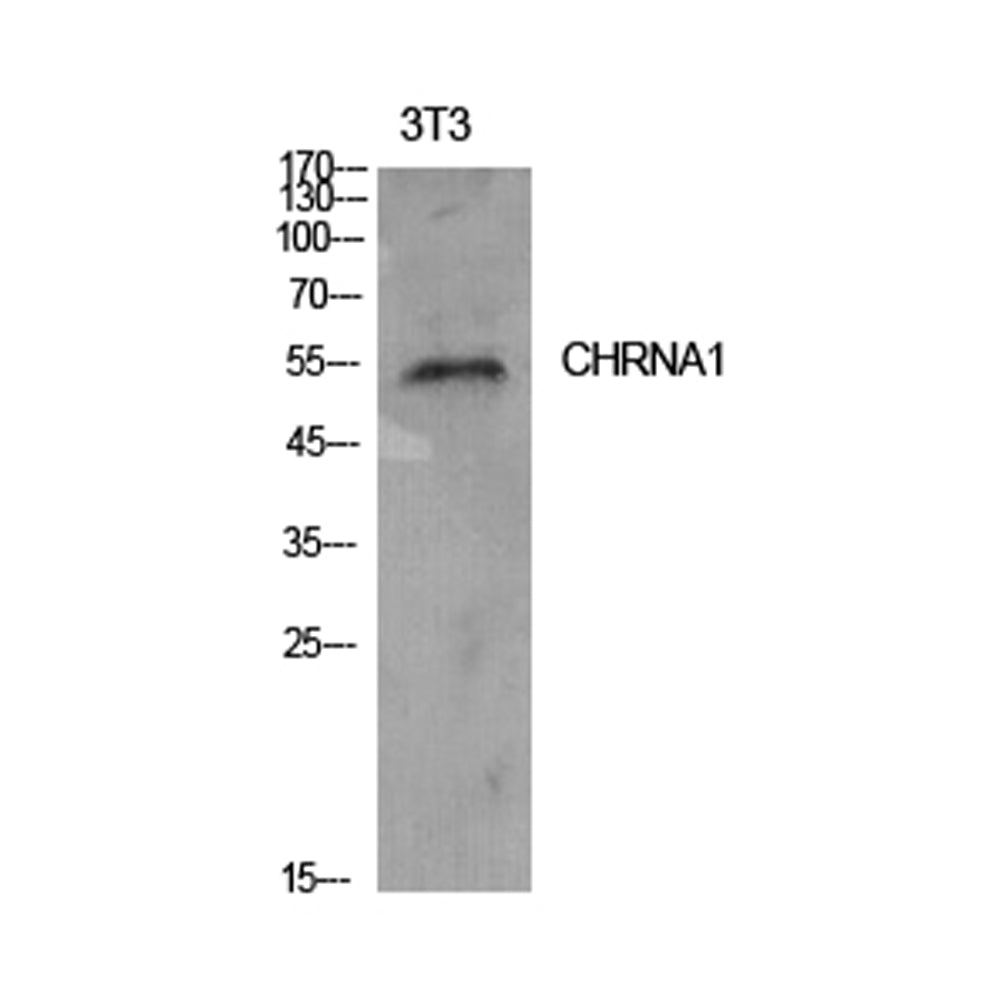 AChR Alpha1 Polyclonal Antibody, 20ul[BT-AP00171]