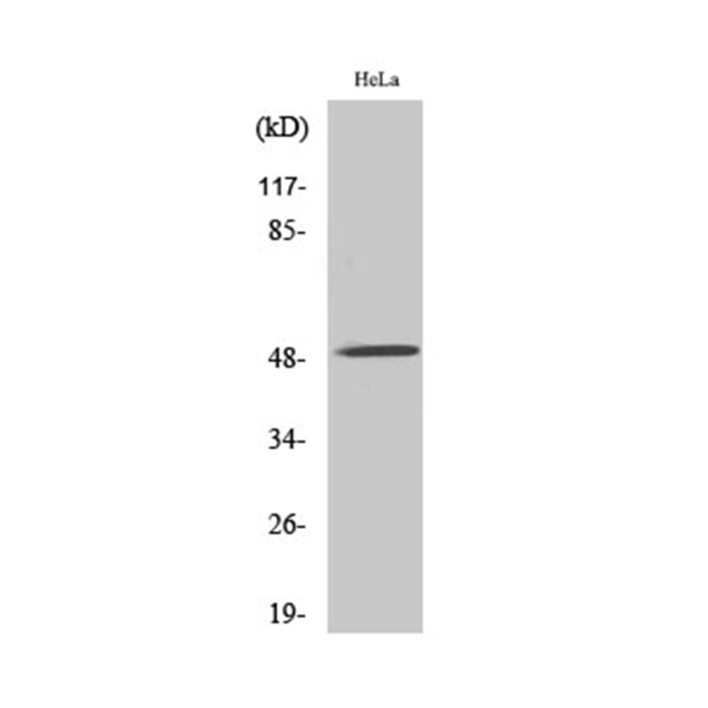 AChR Alpha10 Polyclonal Antibody, 20ul