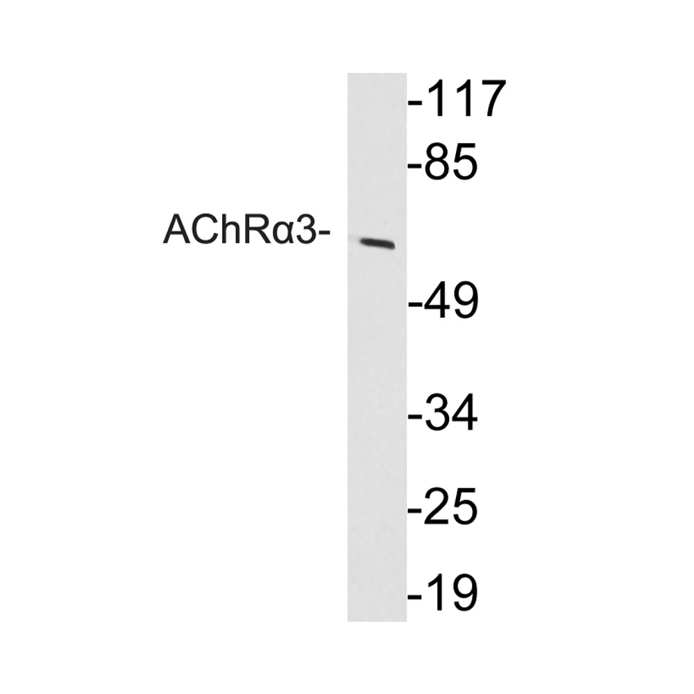AChR Alpha3 Polyclonal Antibody, 20ul
