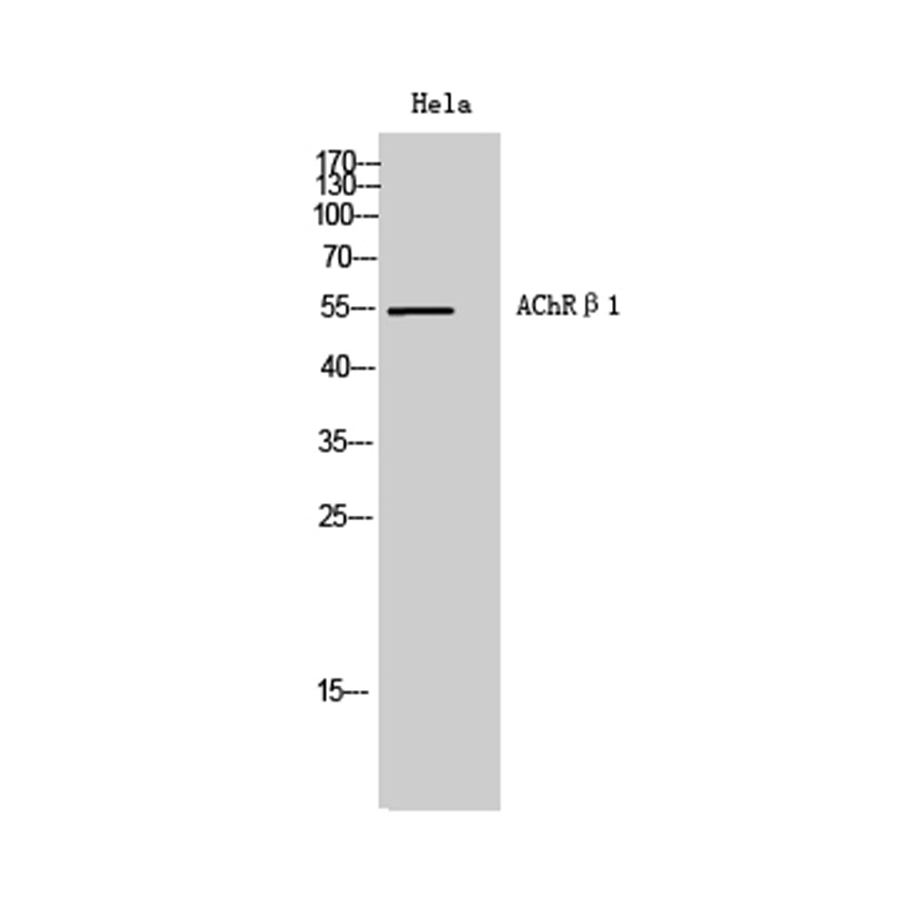 AChRBeta1 Polyclonal Antibody, 20ul