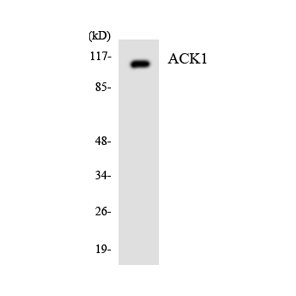 ACK Polyclonal Antibody, 20ul