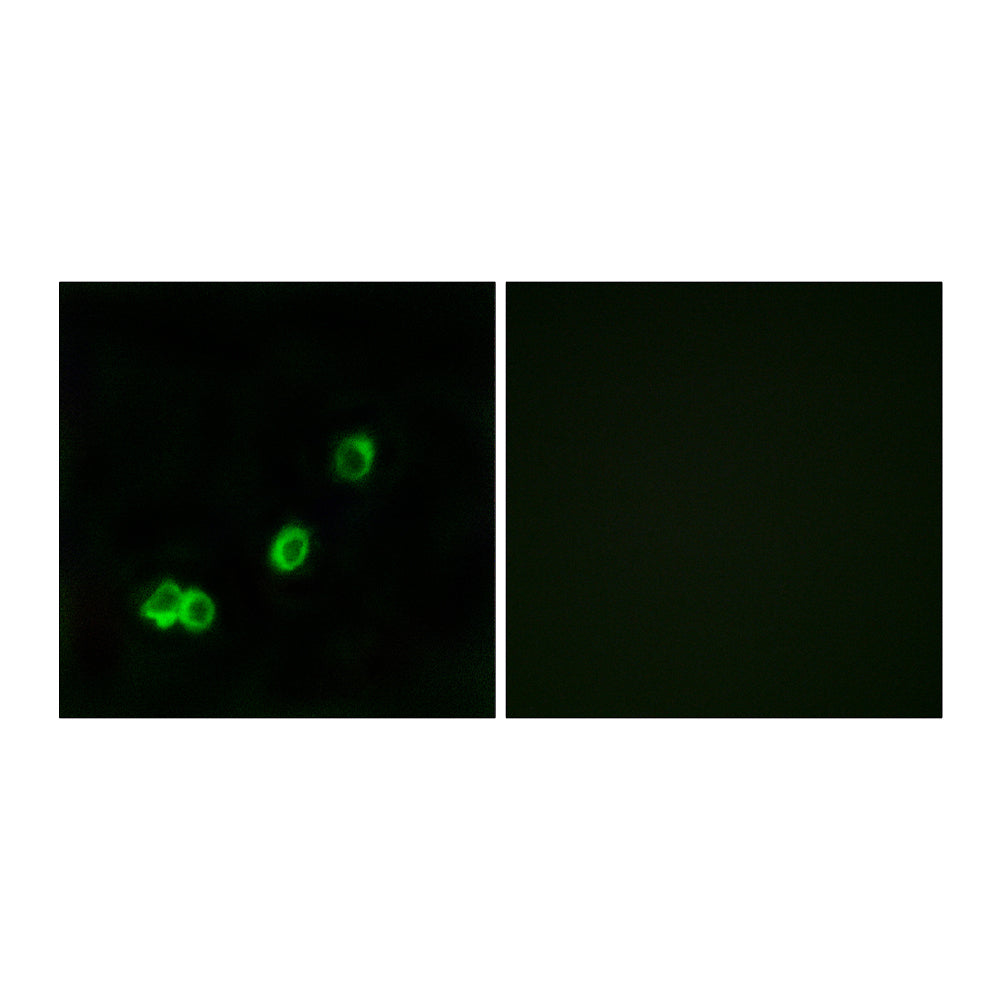 ACOT1 Polyclonal Antibody, 20ul