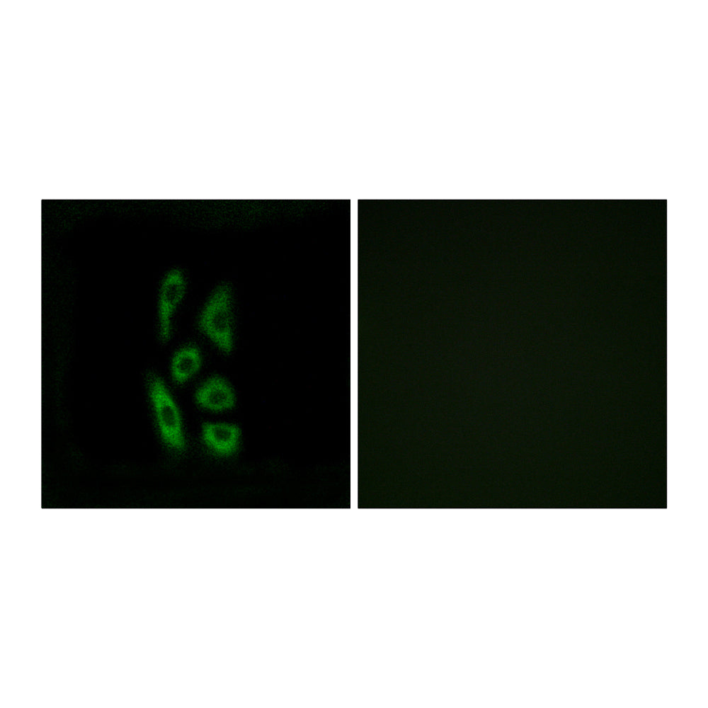 ACOT12 Polyclonal Antibody, 20ul