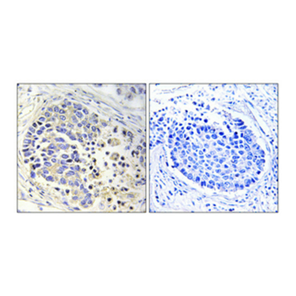 ACOT2 Polyclonal Antibody, 20ul