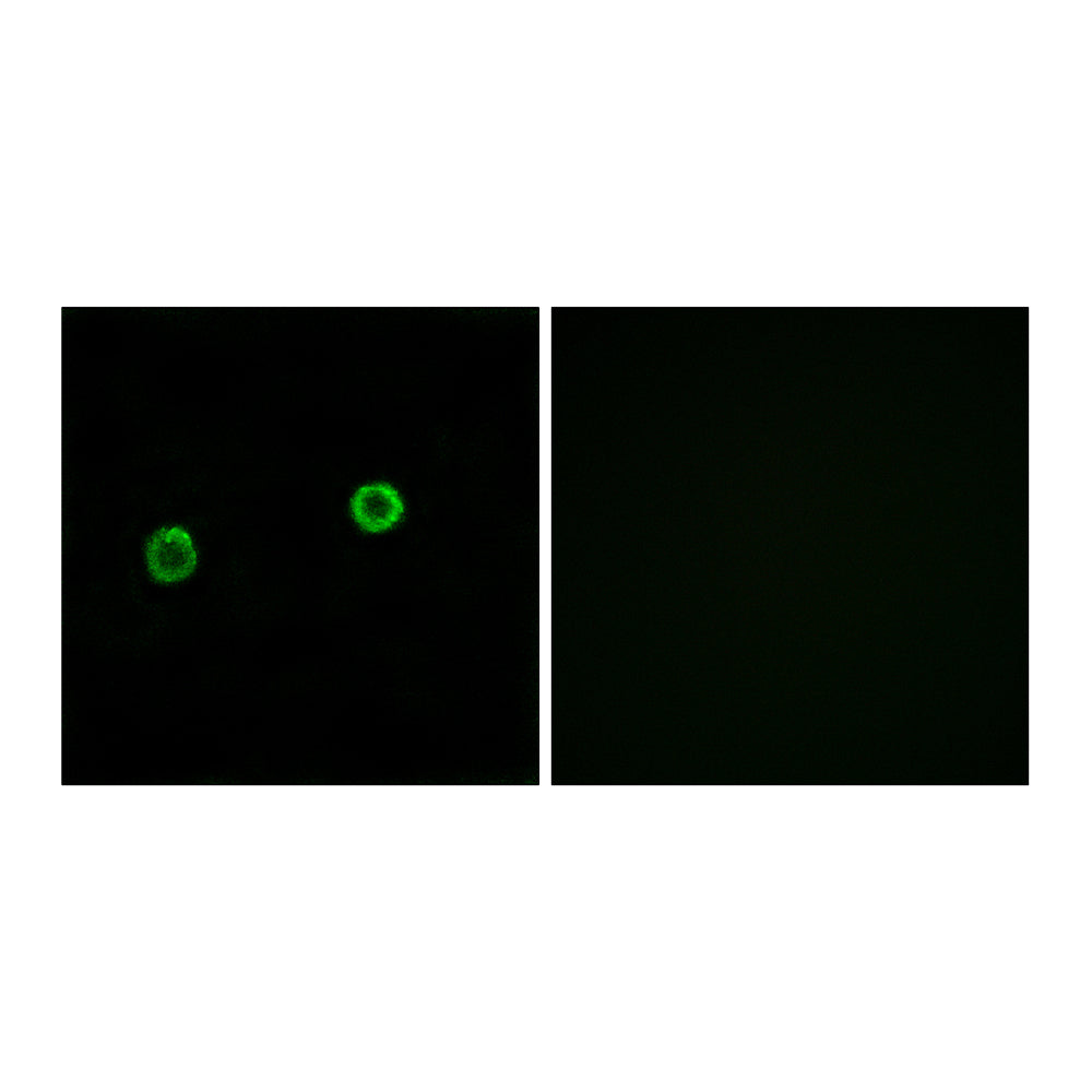 ACOT4 Polyclonal Antibody, 20ul