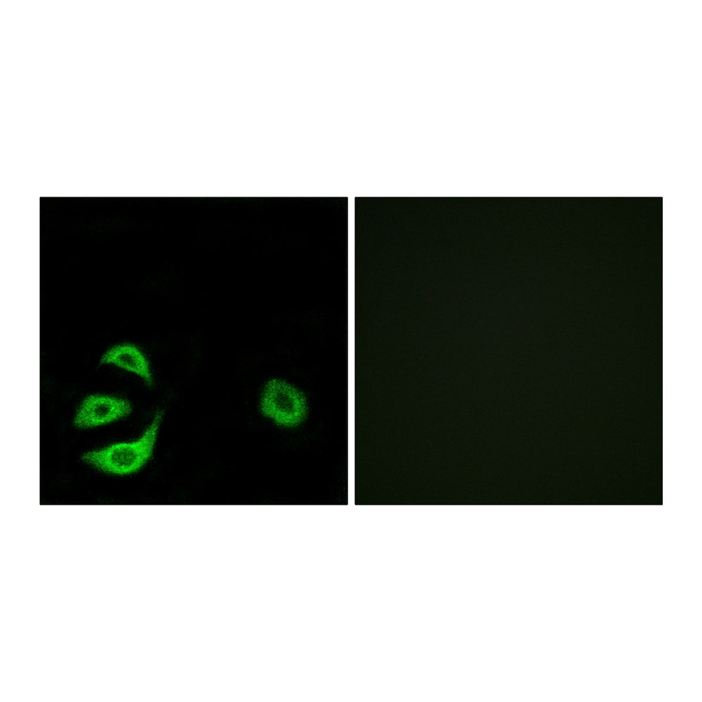 ACOT8 Polyclonal Antibody, 20ul