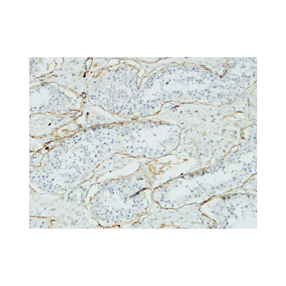 Acrosin Polyclonal Antibody, 20ul