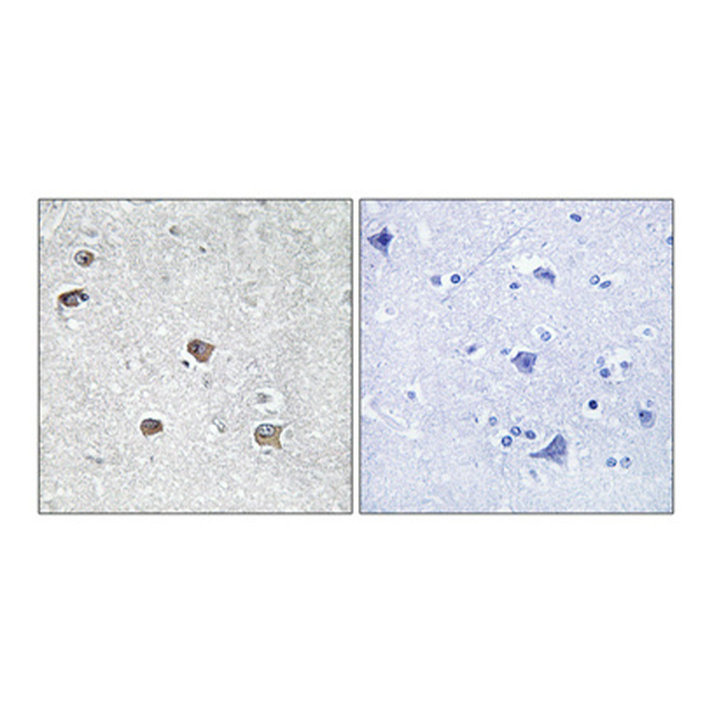 ACSL6 Polyclonal Antibody, 20ul