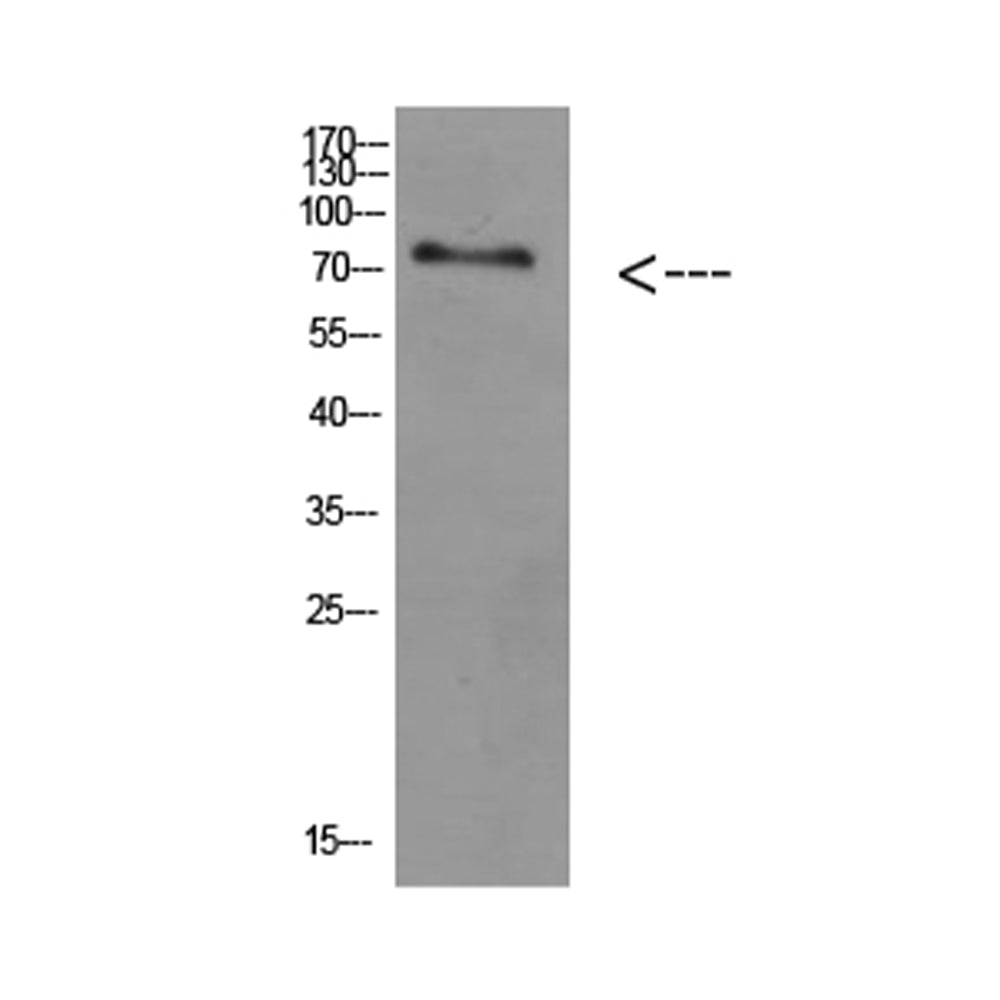 ACSS1 Polyclonal Antibody, 20ul[BT-AP00202]