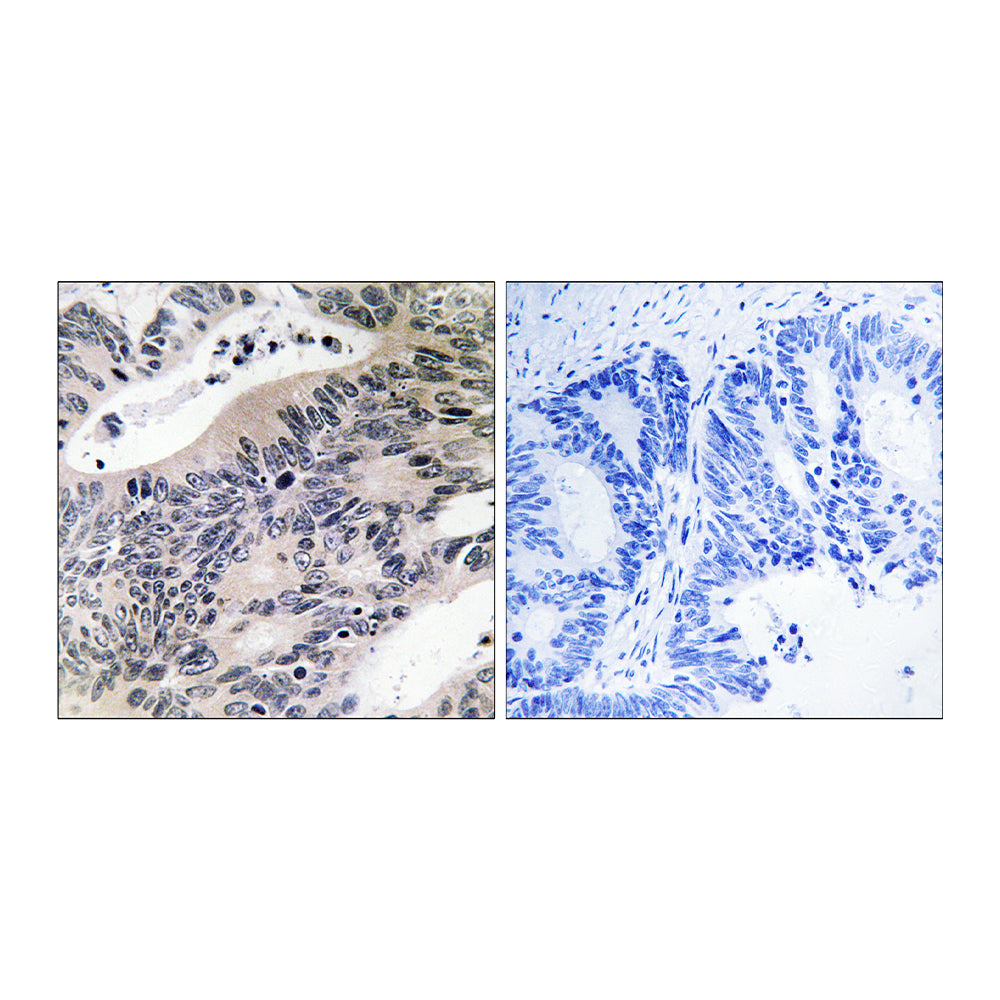 ACSS1 Polyclonal Antibody, 20ul[BT-AP00203]