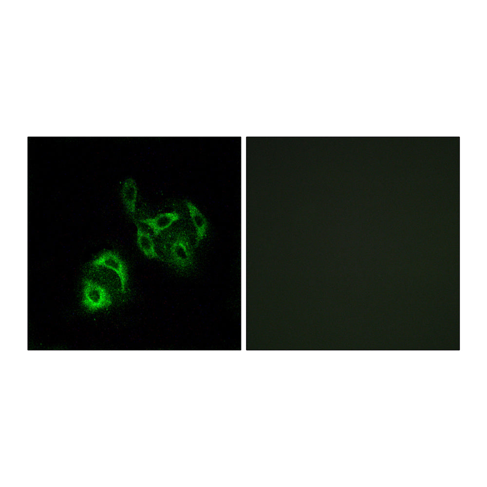 ACSVL4 Polyclonal Antibody, 20ul
