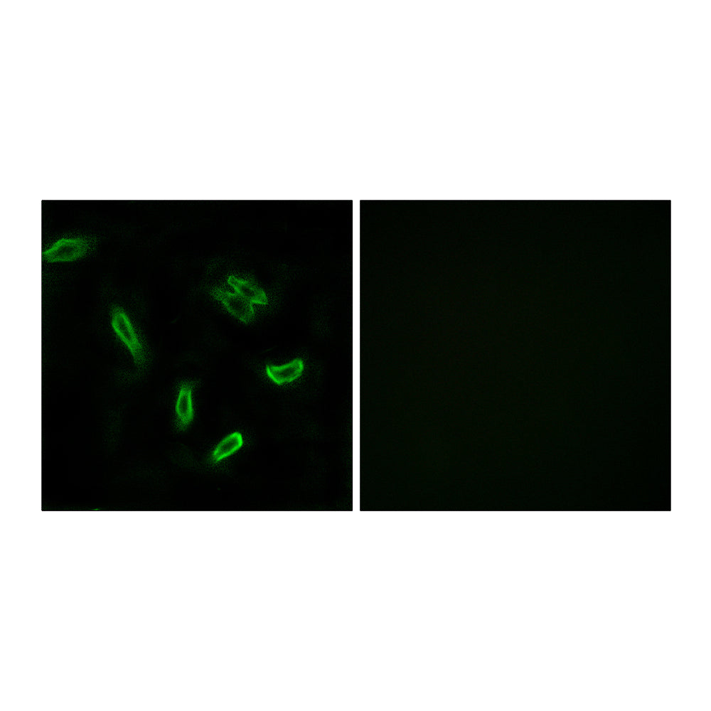 ACSVL6 Polyclonal Antibody, 20ul