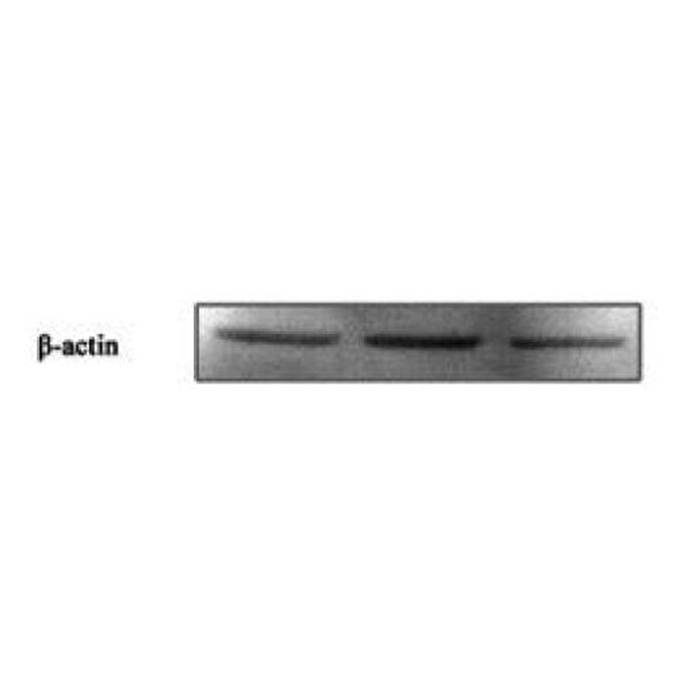 Actin Beta Polyclonal Antibody, 20ul