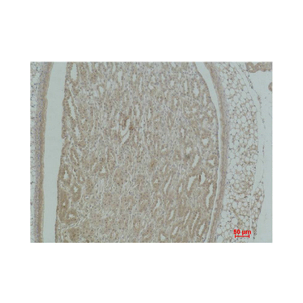 Actinin-Alpha1 Polyclonal Antibody, 20ul[BT-AP00215]