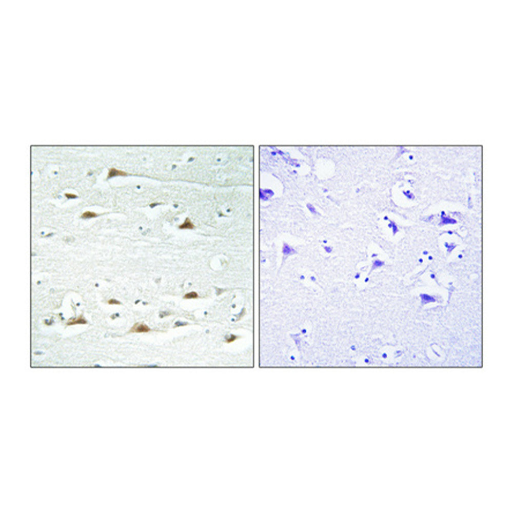 Actinin-Alpha1/2/3/4 Polyclonal Antibody, 20ul
