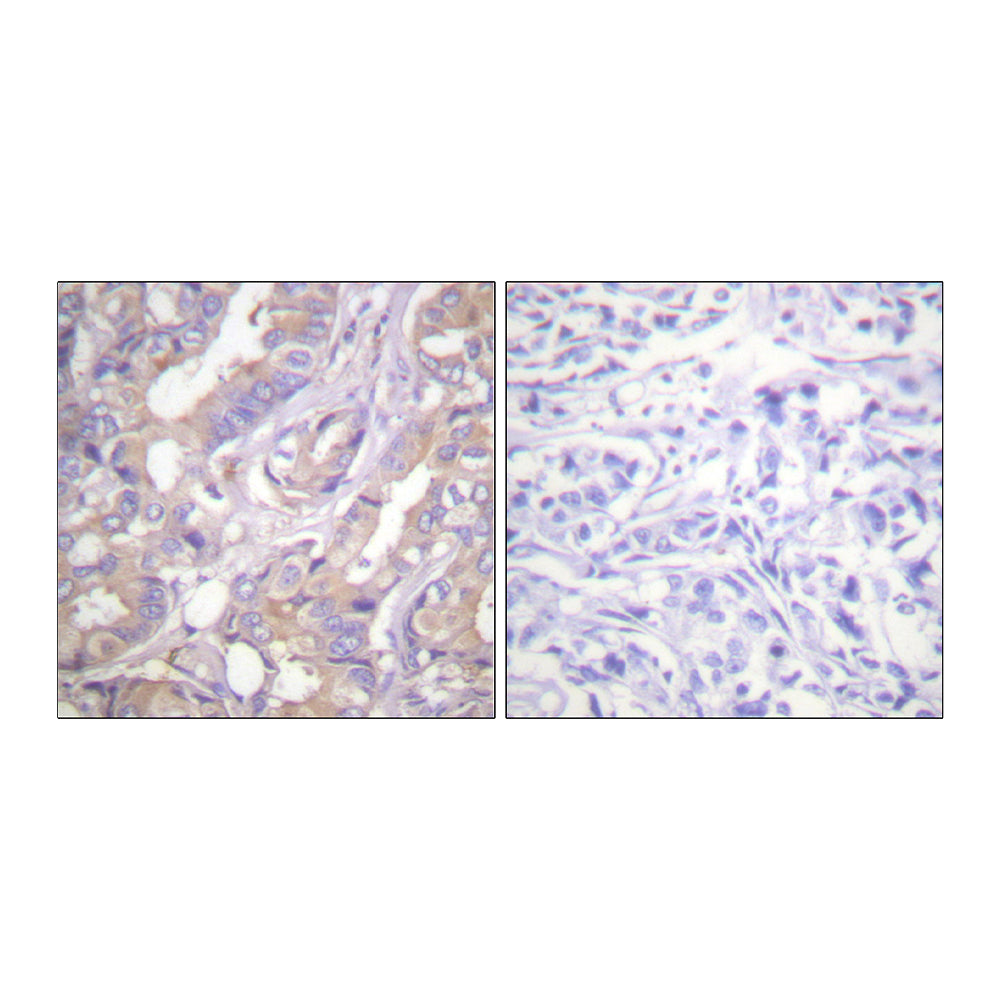 A-Raf Polyclonal Antibody, 100ul[BT-AP00577]